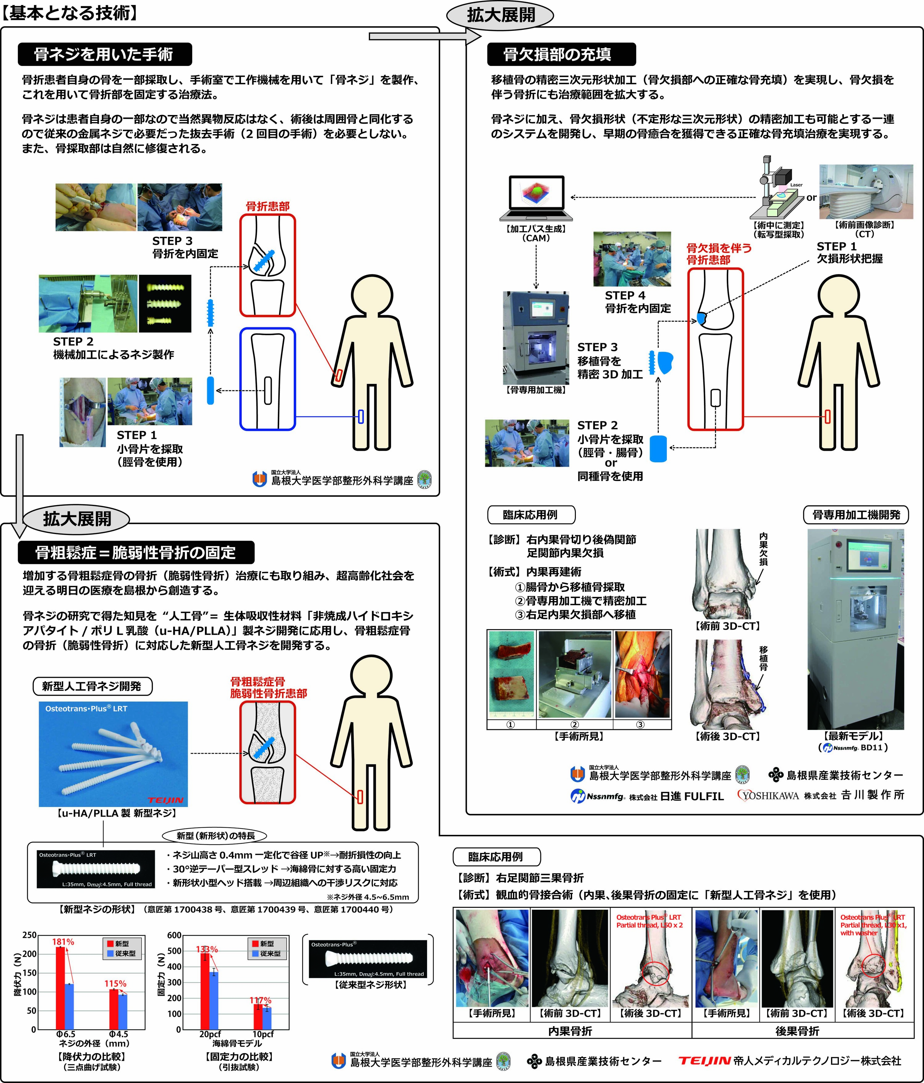 患者の負担軽減を企図する新しい骨折治療支援システムの開発3500